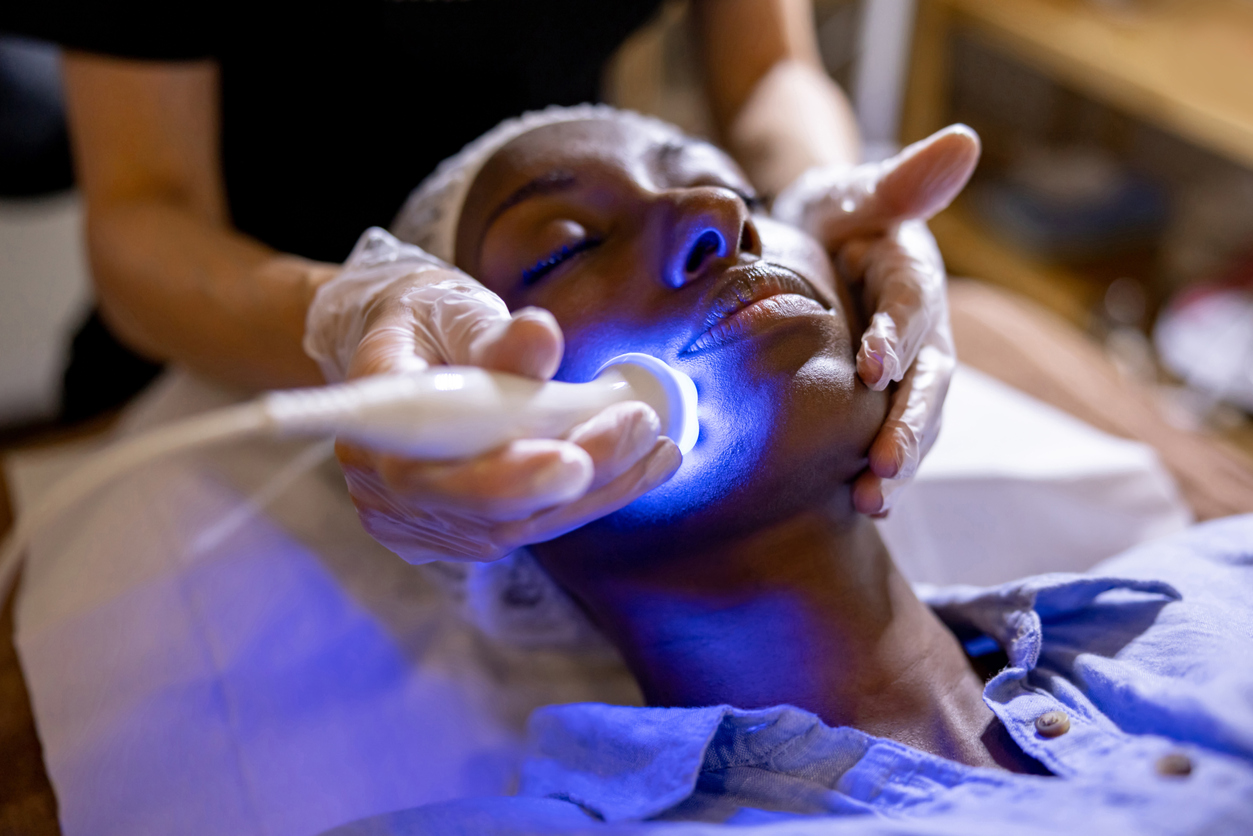 BBL Face Laser Treatment – Benefits, Cost, Risks & FAQ