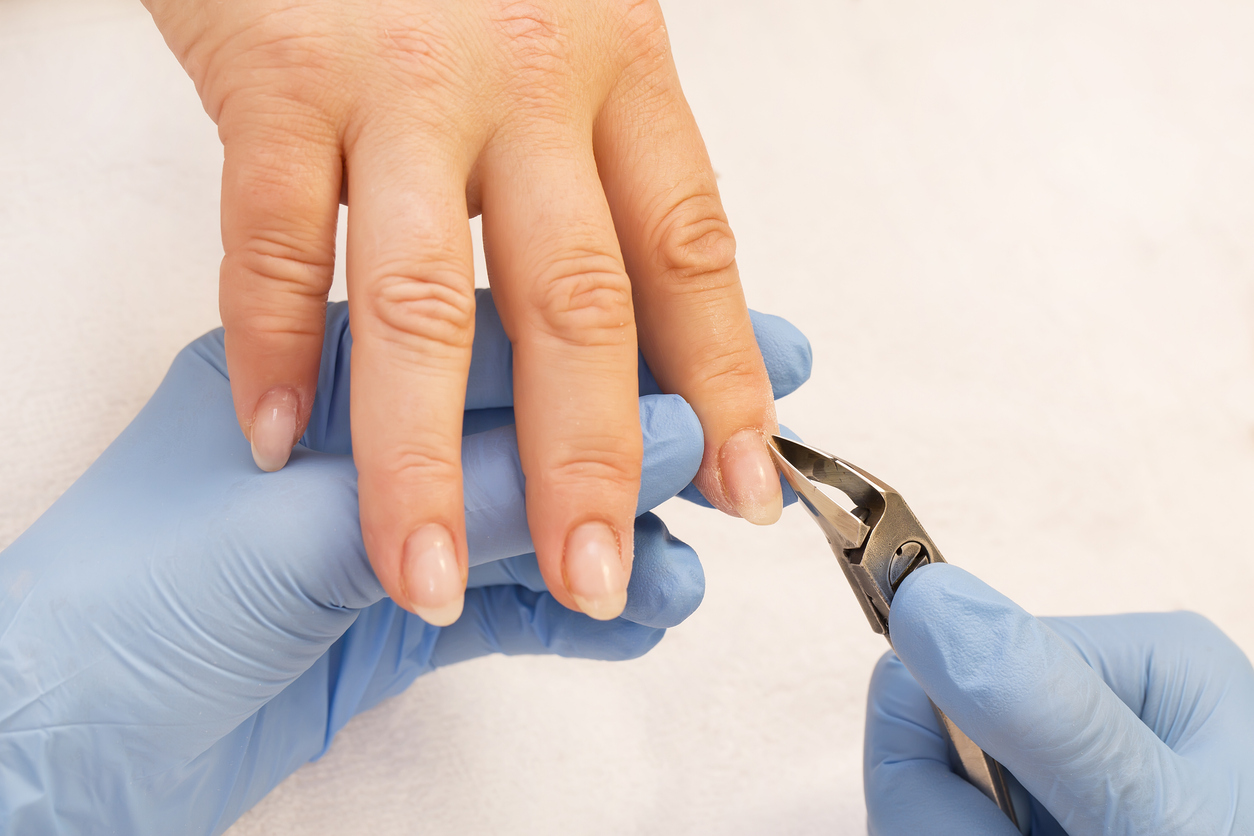 Fingernail Fungus Treatments