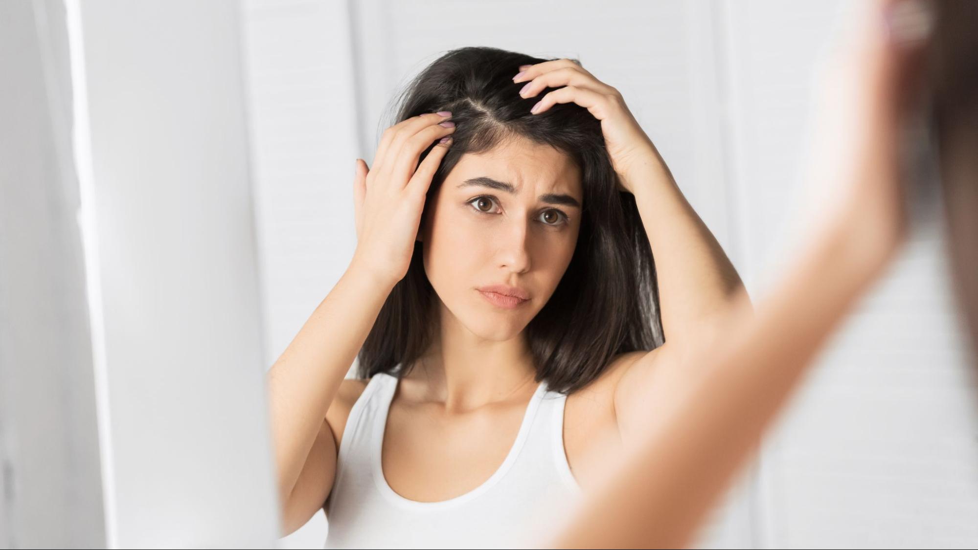 Home Remedies for Dandruff and Dry Scalp